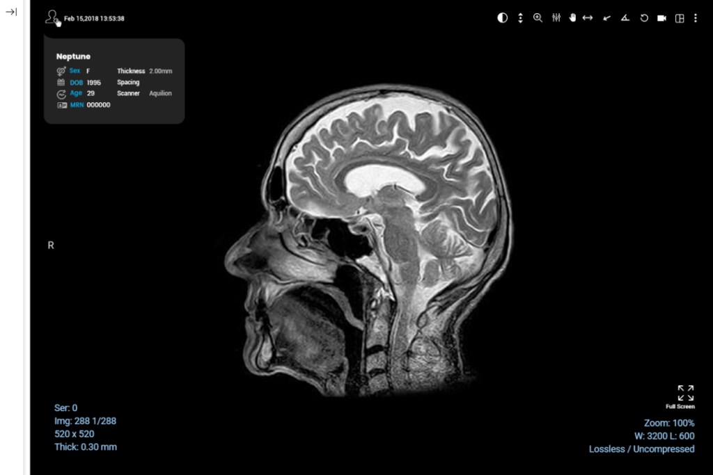 DICOM viewer Web