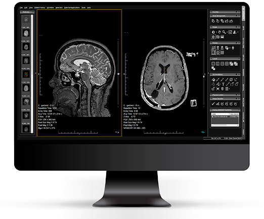DICOM viewer Web