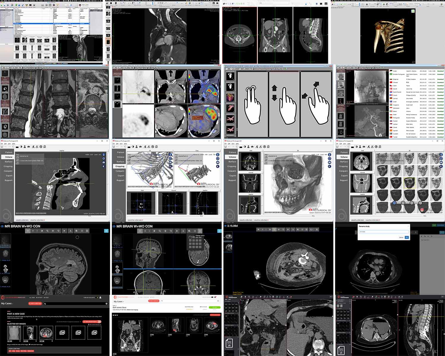 DICOM medical image viewer