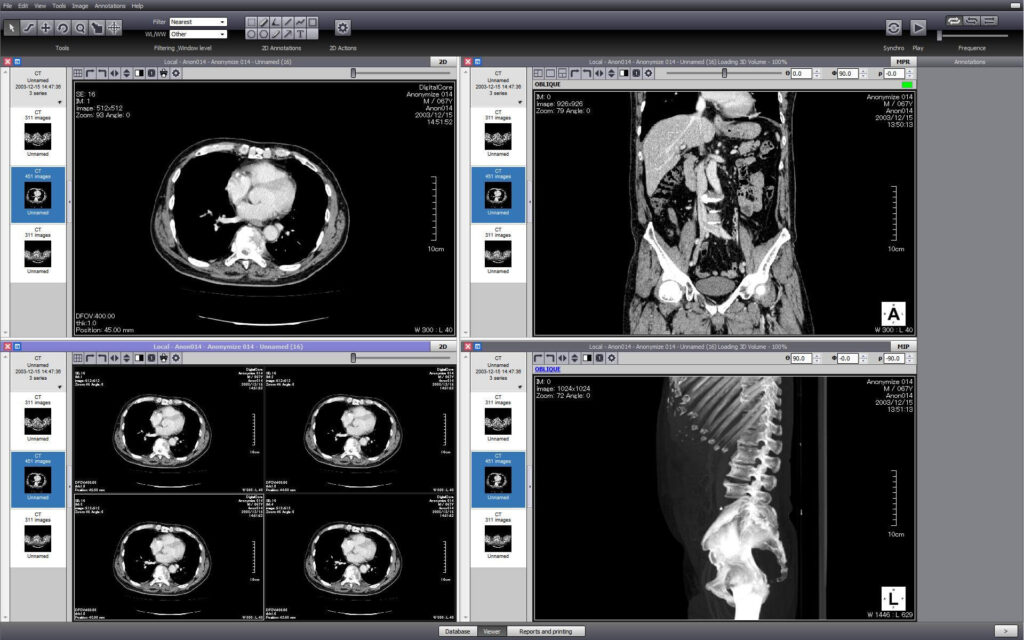 DICOM medical image viewer