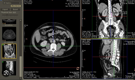 MRI reader online